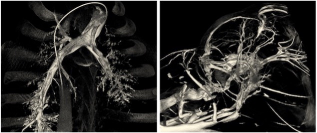 Sample 2-panel animal model using 3D reconstructed angiography