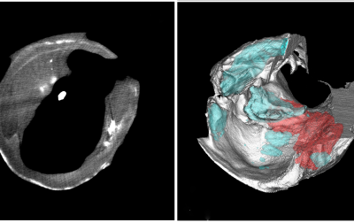 Two frames showing multimodal imaging of carotid arteries