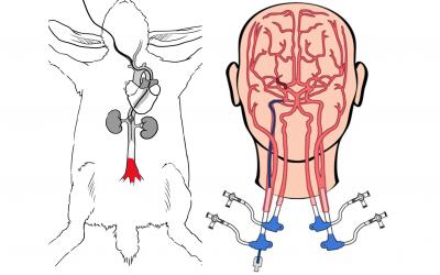 Two schematic illustrations of testing models, with the cerebrovascular system of a rabbit shown on the right and and the human cerebrovascular system shown on the right