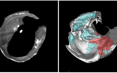 Two frames showing imaging of carotid arteries